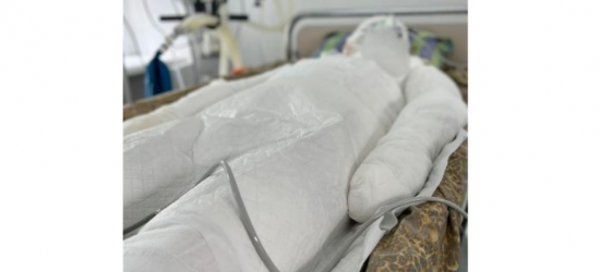 Вибух каністри з пальним: у львівську лікарню потрапив чоловік з 80% опіків тіла 