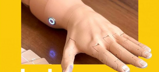 Львів’янину, який втратив руку, встановили найлегший у світі протез, надрукований на 3D-принтері