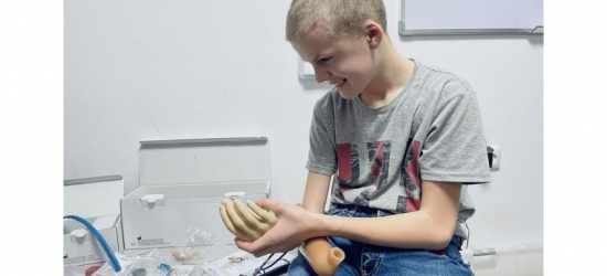 У львівському центрі НЕЗЛАМНІ запустили дитяче протезування
